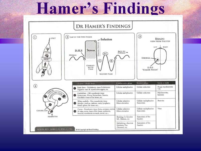 Emotional roots in Brain Cancers page 33